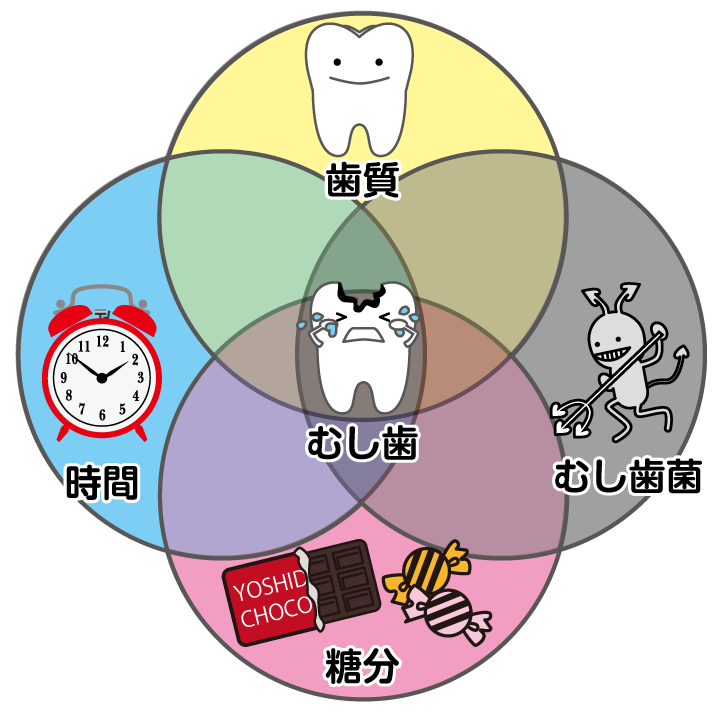 むし歯の原因、知ってますか?