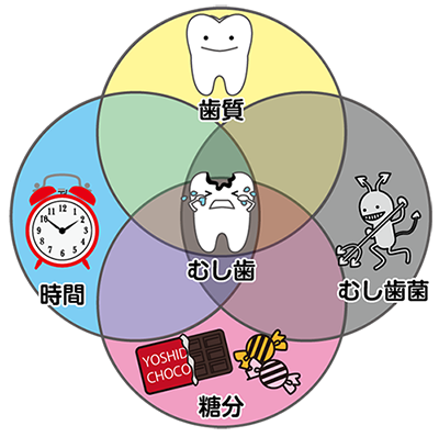 カイスの輪